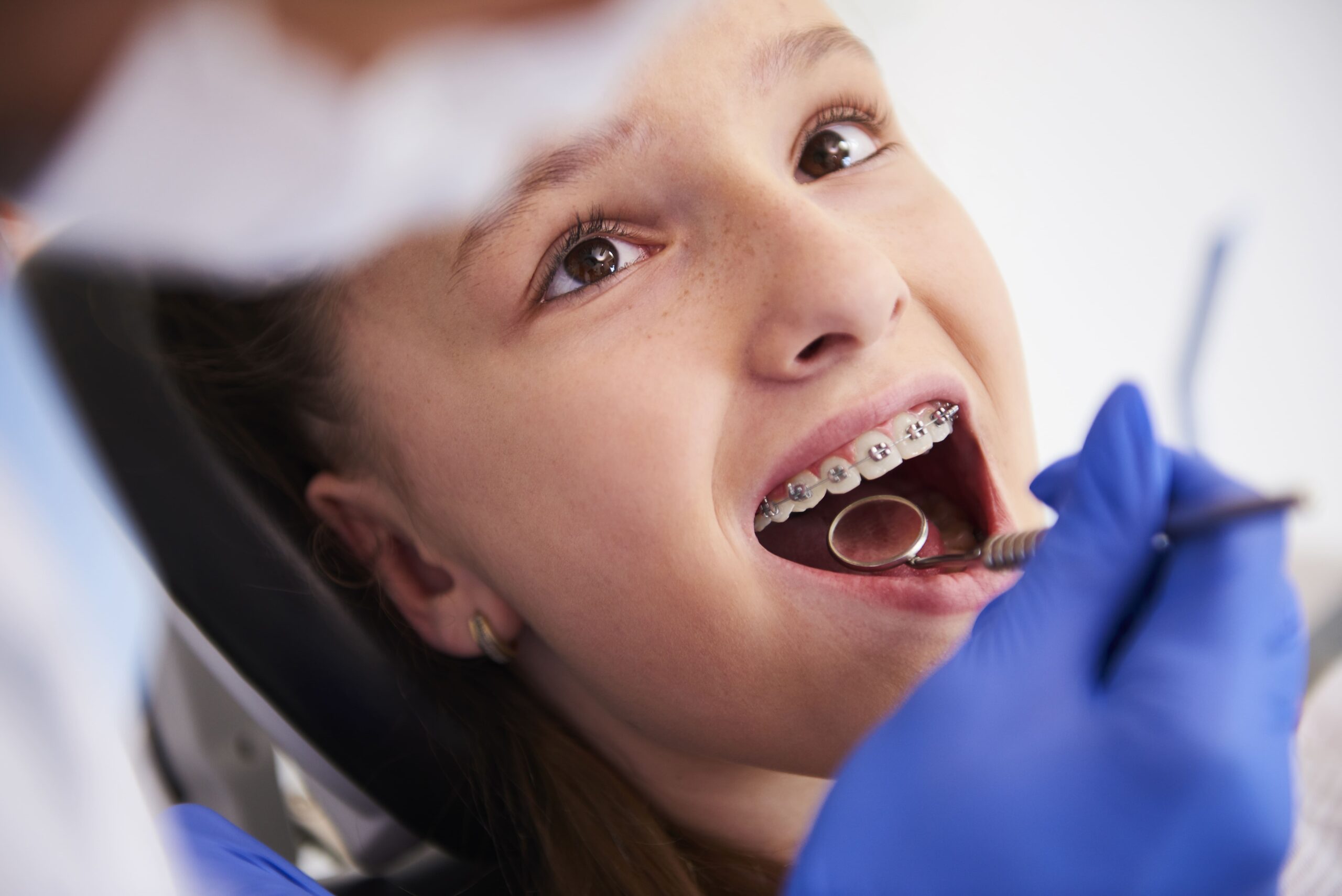 girl-with-braces-routine-dental-examination (1)